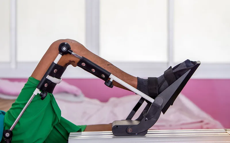 Treatments Continuous Passive Motion CPM